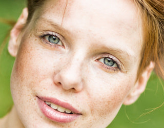 chirurgie annecy geneve face cou menton rajeunissement lifting paupieres rides blepharoplastie cervico facial